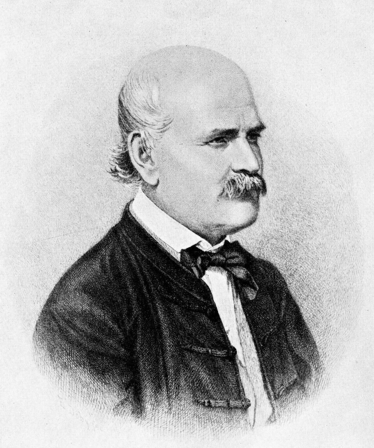 Ignaz Semmelweis, Pioneer of Antiseptic Procedures